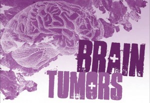 cell phone brain tumors