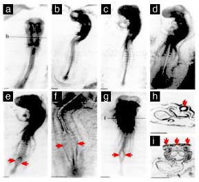 cellphone radiation birth defects