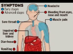 A Well Defined Diagram Of The Symptoms Of Ebola Disease