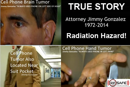 Jimmy-Gonzalez-Cell-Phone-Cancer-Brain-Cancer-Hand-Cancer-Chest-Cancer-RF-RADIATION-1