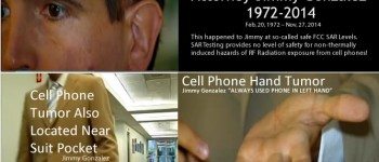 Jimmy-Gonzalez-Cell-Phone-Cancer-Brain-Cancer-Hand-Cancer-Chest-Cancer-RF-RADIATION