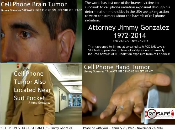 Jimmy-Gonzalez-Cell-Phone-Cancer-Brain-Cancer-Hand-Cancer-Chest-Cancer-RF-RADIATION