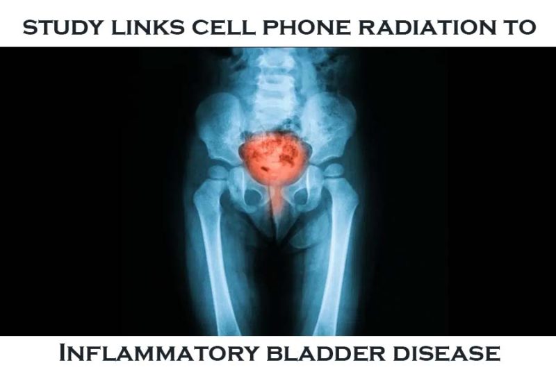 study-links-cell-phone-radiation-inflammatory-bladder-disease